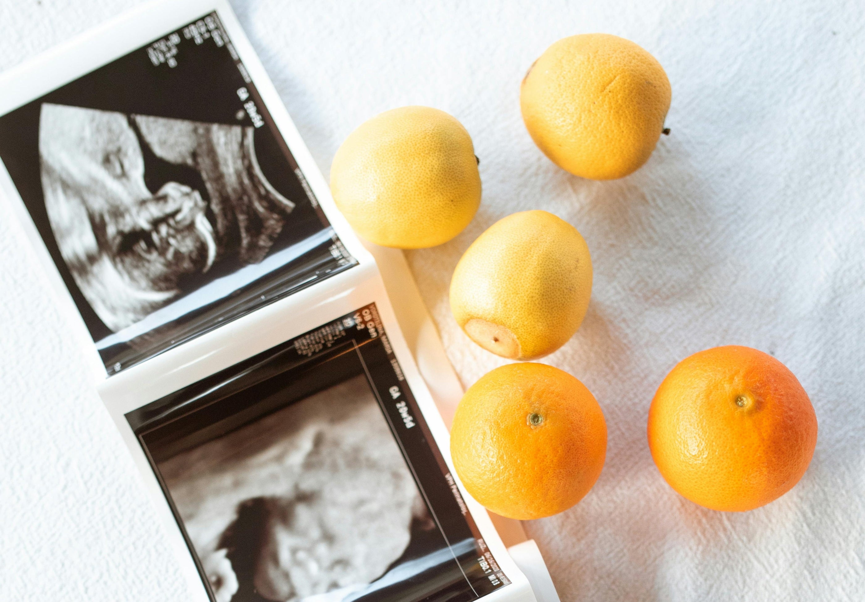 Sonogram photo with clementine oranges